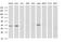 Malonyl-CoA-acyl carrier protein transacylase, mitochondrial antibody, MA5-26314, Invitrogen Antibodies, Western Blot image 