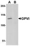 Glycoprotein VI Platelet antibody, orb75048, Biorbyt, Western Blot image 