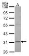 X-Ray Repair Cross Complementing 3 antibody, LS-C185340, Lifespan Biosciences, Western Blot image 