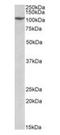Pre-MRNA Processing Factor 6 antibody, orb137170, Biorbyt, Western Blot image 