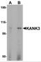 KN Motif And Ankyrin Repeat Domains 3 antibody, NBP2-82100, Novus Biologicals, Western Blot image 