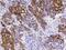 Keratin 14 antibody, GTX02091, GeneTex, Immunohistochemistry paraffin image 