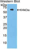 Serine Peptidase Inhibitor, Kazal Type 5 antibody, LS-C298752, Lifespan Biosciences, Western Blot image 