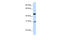 Glycolipid Transfer Protein Domain Containing 2 antibody, 25-995, ProSci, Western Blot image 