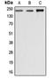 Dysferlin antibody, orb214774, Biorbyt, Western Blot image 