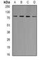 Mitogen-Activated Protein Kinase Kinase Kinase 1 antibody, orb388427, Biorbyt, Western Blot image 