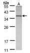 Ornithine Carbamoyltransferase antibody, PA5-28197, Invitrogen Antibodies, Western Blot image 