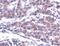 TNF Receptor Superfamily Member 1B antibody, PA5-32622, Invitrogen Antibodies, Immunohistochemistry paraffin image 
