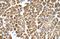 Tropomyosin 2 antibody, PA5-43143, Invitrogen Antibodies, Immunohistochemistry frozen image 