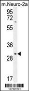 Transmembrane Protein 65 antibody, 55-146, ProSci, Western Blot image 