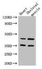 Actin Like 9 antibody, LS-C677057, Lifespan Biosciences, Western Blot image 