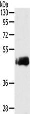 Endosome Associated Trafficking Regulator 1 antibody, TA323350, Origene, Western Blot image 