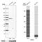 Copine 1 antibody, HPA047259, Atlas Antibodies, Western Blot image 