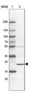 Heat Shock Protein Nuclear Import Factor Hikeshi antibody, NBP2-33986, Novus Biologicals, Western Blot image 