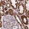 ATP Synthase F1 Subunit Alpha antibody, NBP2-38525, Novus Biologicals, Immunohistochemistry paraffin image 