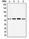 Forkhead Box O4 antibody, orb214252, Biorbyt, Western Blot image 
