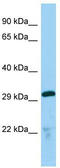 Thioredoxin-related transmembrane protein 2 antibody, TA341991, Origene, Western Blot image 