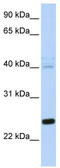 Heat Shock Protein Family B (Small) Member 8 antibody, TA334525, Origene, Western Blot image 