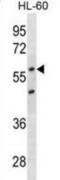 Cyclin Dependent Kinase Inhibitor 1C antibody, abx025449, Abbexa, Western Blot image 