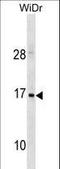 Hemoglobin Subunit Zeta antibody, LS-C157800, Lifespan Biosciences, Western Blot image 