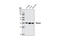 Serpin Family B Member 5 antibody, 9119S, Cell Signaling Technology, Western Blot image 