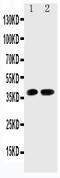 Cyclin Dependent Kinase 6 antibody, PA2125-2, Boster Biological Technology, Western Blot image 