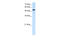 Solute Carrier Family 25 Member 25 antibody, ARP43761_P050, Aviva Systems Biology, Western Blot image 