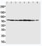 Minichromosome Maintenance Complex Component 7 antibody, LS-C312940, Lifespan Biosciences, Western Blot image 