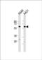 Cytochrome P450 2J2 antibody, PA5-72421, Invitrogen Antibodies, Western Blot image 