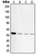 Protein Kinase CAMP-Activated Catalytic Subunit Beta antibody, LS-C352701, Lifespan Biosciences, Western Blot image 