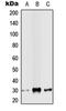 Snail Family Transcriptional Repressor 2 antibody, orb215521, Biorbyt, Western Blot image 