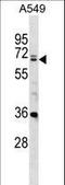 DEAD-Box Helicase 28 antibody, LS-C167333, Lifespan Biosciences, Western Blot image 