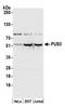 Pseudouridine Synthase 3 antibody, A304-958A, Bethyl Labs, Western Blot image 