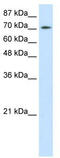 Zinc Finger And BTB Domain Containing 48 antibody, TA329704, Origene, Western Blot image 