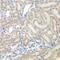 AU RNA Binding Methylglutaconyl-CoA Hydratase antibody, GTX55527, GeneTex, Immunohistochemistry paraffin image 