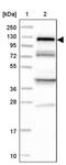 Huntingtin Interacting Protein 1 Related antibody, PA5-58260, Invitrogen Antibodies, Western Blot image 