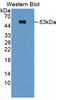 Rho GDP Dissociation Inhibitor Beta antibody, abx128095, Abbexa, Western Blot image 