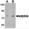 Nibrin antibody, MBS150257, MyBioSource, Western Blot image 