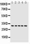 Caspase 6 antibody, PA1441, Boster Biological Technology, Western Blot image 
