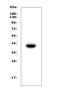Forkhead Box E1 antibody, A02831-5, Boster Biological Technology, Western Blot image 