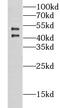 Carbohydrate Sulfotransferase 9 antibody, FNab01698, FineTest, Western Blot image 