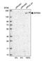 Zinc Finger Protein 654 antibody, PA5-57557, Invitrogen Antibodies, Western Blot image 