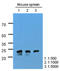 Osteoclast Stimulating Factor 1 antibody, LS-B6271, Lifespan Biosciences, Western Blot image 