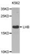 Luteinizing Hormone Beta Polypeptide antibody, abx002179, Abbexa, Western Blot image 