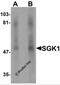 Serum/Glucocorticoid Regulated Kinase 1 antibody, 6319, ProSci Inc, Western Blot image 