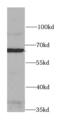 Heat Shock Transcription Factor 2 antibody, FNab04037, FineTest, Western Blot image 