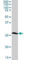 Thiamine Triphosphatase antibody, H00079178-B01P, Novus Biologicals, Western Blot image 