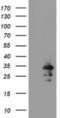 RNA-binding protein with multiple splicing antibody, NBP2-03905, Novus Biologicals, Western Blot image 