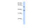 Solute Carrier Family 25 Member 16 antibody, 25-930, ProSci, Western Blot image 