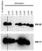 CD247 Molecule antibody, M02421-2, Boster Biological Technology, Western Blot image 